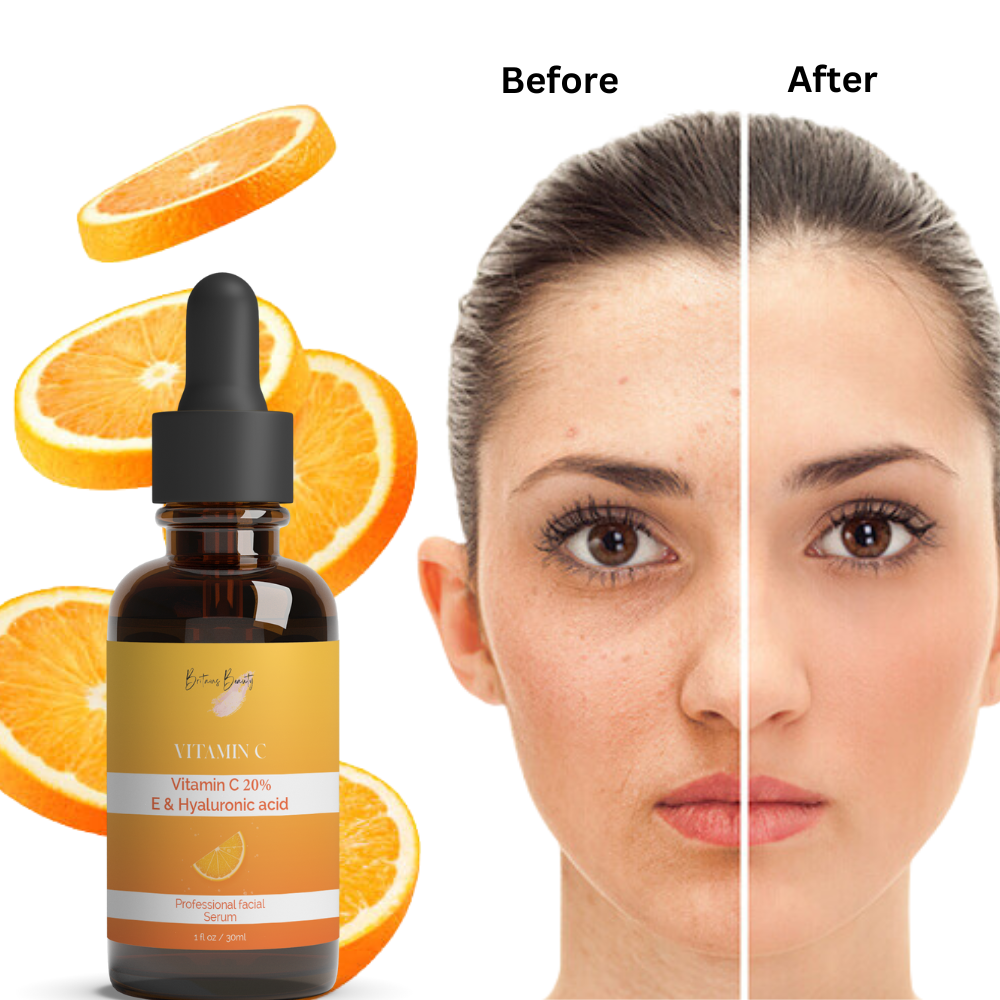 Britain’s Beauty Vitamin C Serum 30ML with 20% Vitamin C, Hyaluronic Acid, and Vitamin E for Anti-Aging, Brightening, and Skin Hydration – Organic Facial Serum for Wrinkle Reduction and Collagen Boosting