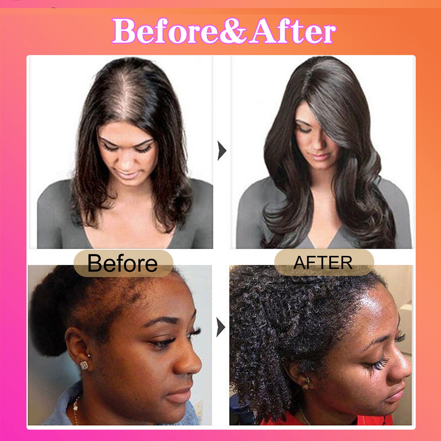 Batana Oil Hair Conditioner - Promotes Growth, Nourishes Scalp, Enhances Texture & Reduces Split Ends - 120ml