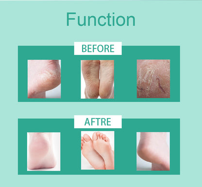Tea Tree Exfoliating Foot Mask for Soft, Smooth Feet - Natural Skin Peeling Treatment - Hydrates, Nourishes & Repairs Cracked Heels - Easy-to-Use Home Spa Experience - 2 Pairs