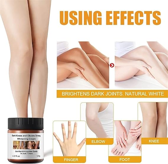 Dark Knees and Elbows Strong Whitening Cream - Powerful Skin Lightening, Moisturizing Formula for Dark Patches, Knuckles, and Elbows - Gentle, Effective Whitening Cream - 120g