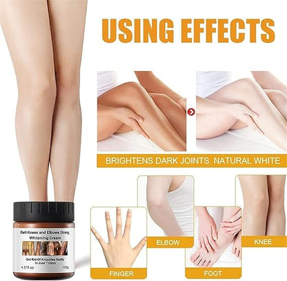Dark Knees and Elbows Strong Whitening Cream - Powerful Skin Lightening, Moisturizing Formula for Dark Patches, Knuckles, and Elbows - Gentle, Effective Whitening Cream - 120g