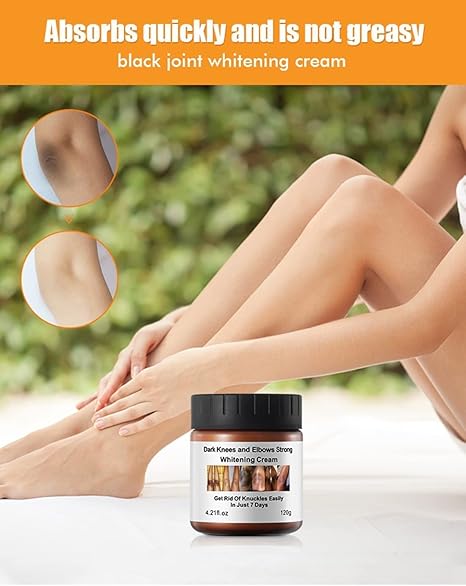 Dark Knees and Elbows Strong Whitening Cream - Powerful Skin Lightening, Moisturizing Formula for Dark Patches, Knuckles, and Elbows - Gentle, Effective Whitening Cream - 120g
