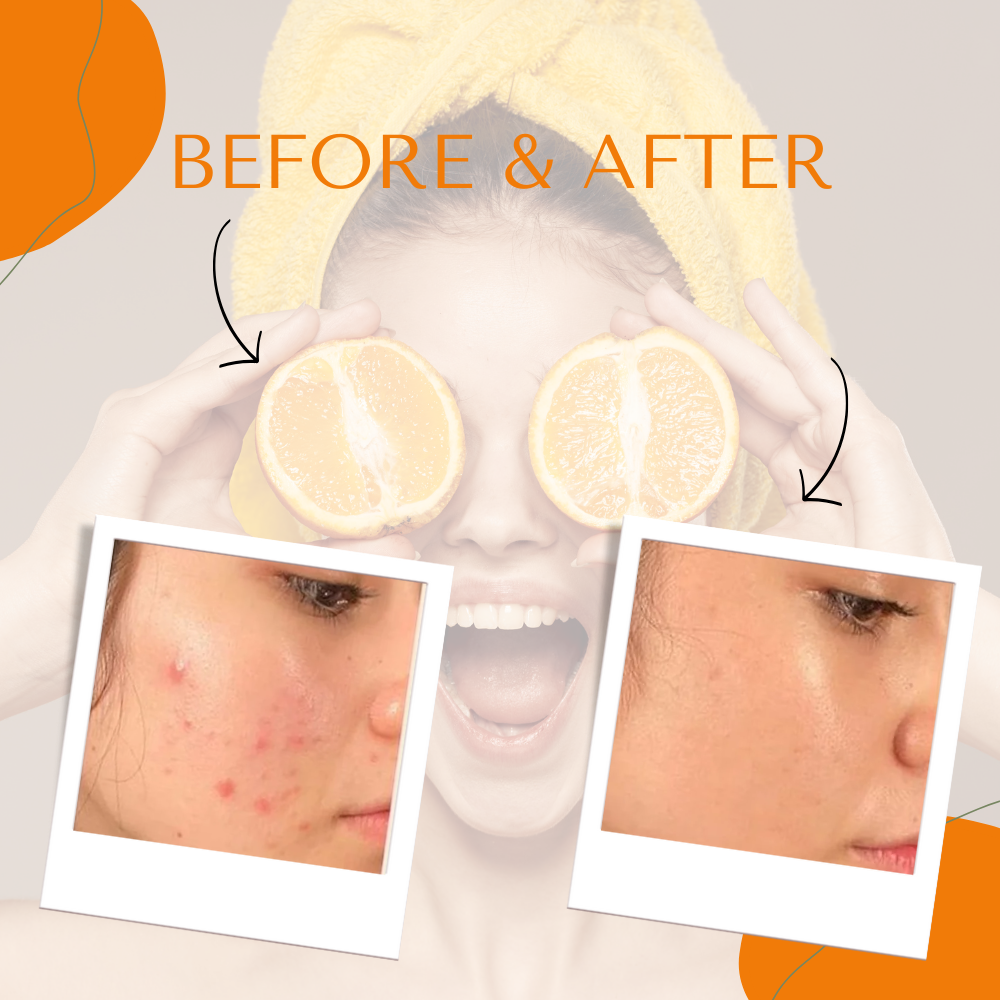Britain's Beauty Vitamin C Soothe Repair Crystal Jelly Mask – Pure Organic, Hydrates, Nourishes, and Reduces Inflammation – 650g/23 fl.oz