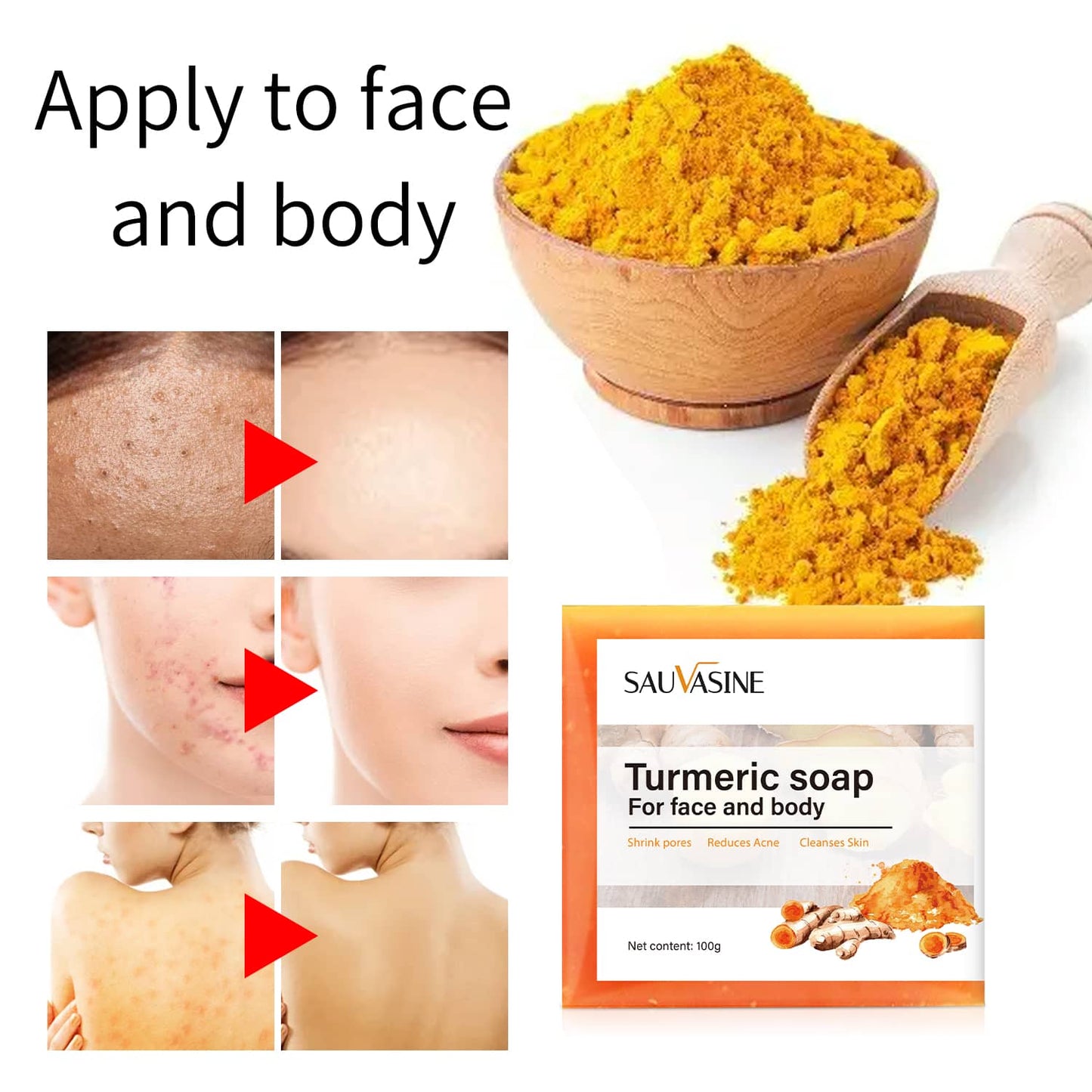 Britains Beauty Turmeric Soap for Face and Body - Natural Acne Treatment, Pore Shrinker, Anti-Inflammatory, Skin Cleanser - 100g