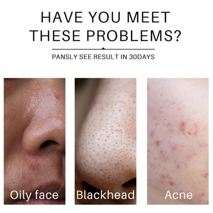 Britains Beauty Turmeric Facial Cleanser - Deep Cleansing, Acne Treatment, pH 5.5, Sweet Aroma, Lightens Dark Spots, Vegan & Cruelty-Free, 50g