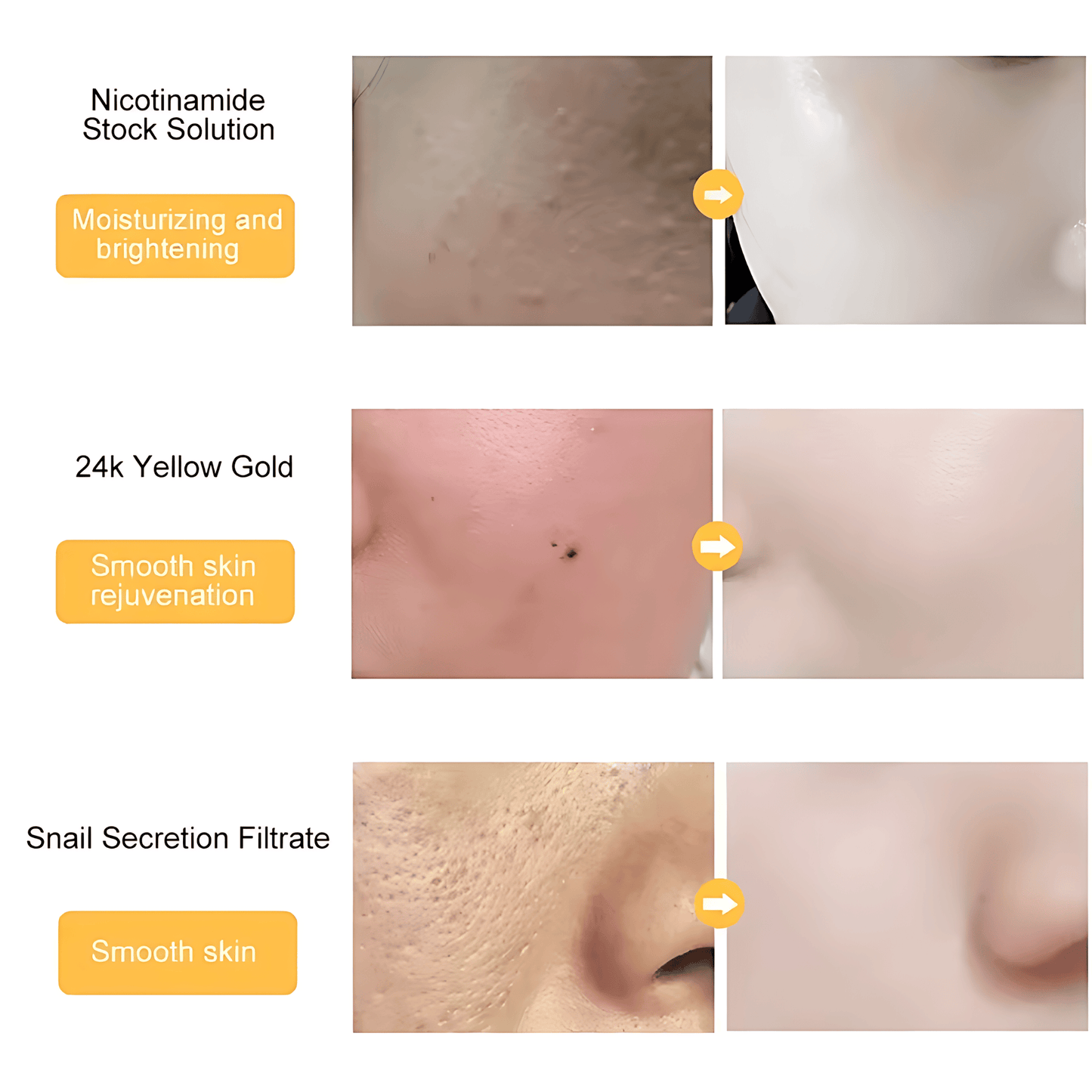 Luxurious 24K Goldzan Ampoule - 99.9% Pure Gold Serum for Deep Moisturizing, Brightening, and Skin Rejuvenation - Anti-Aging Essence with Niacinamide, Gold Foil, and Snail Secretion Filtrate