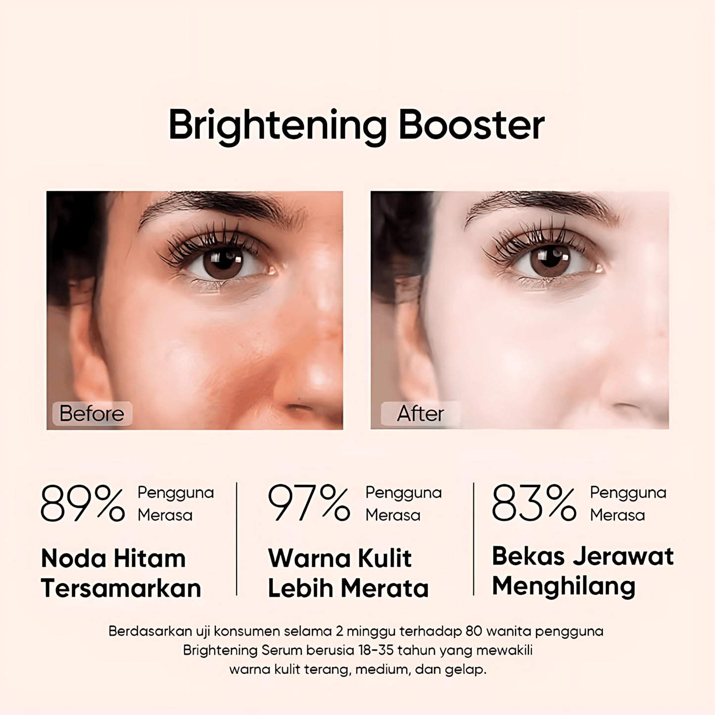 Niacinamide 10% + Zinc 1% Serum - Advanced Whitening, Oil Control, Anti-Aging, Pore Shrinking & Spot Lightening Treatment, 30ml