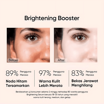 Niacinamide 10% + Zinc 1% Serum - Advanced Whitening, Oil Control, Anti-Aging, Pore Shrinking & Spot Lightening Treatment, 30ml