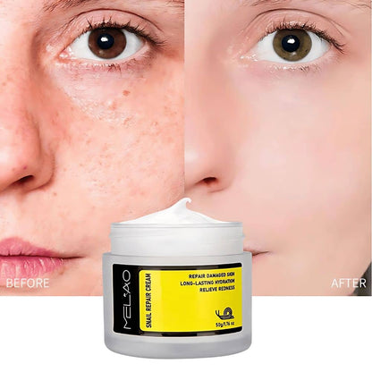 Snail Repair Cream for Face and Neck - Advanced Hydration, Reduces Redness, Heals Skin Damage, Promotes Clear & Radiant Complexion - 50g/1.76 oz