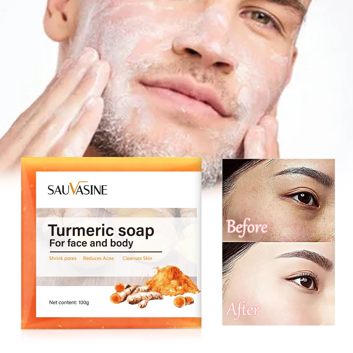Britains Beauty Turmeric Soap for Face and Body - Natural Acne Treatment, Pore Shrinker, Anti-Inflammatory, Skin Cleanser - 100g