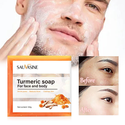Britains Beauty Turmeric Soap for Face and Body - Natural Acne Treatment, Pore Shrinker, Anti-Inflammatory, Skin Cleanser - 100g