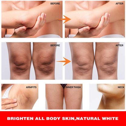 Dark Knees and Elbows Strong Whitening Cream - Powerful Skin Lightening, Moisturizing Formula for Dark Patches, Knuckles, and Elbows - Gentle, Effective Whitening Cream - 120g