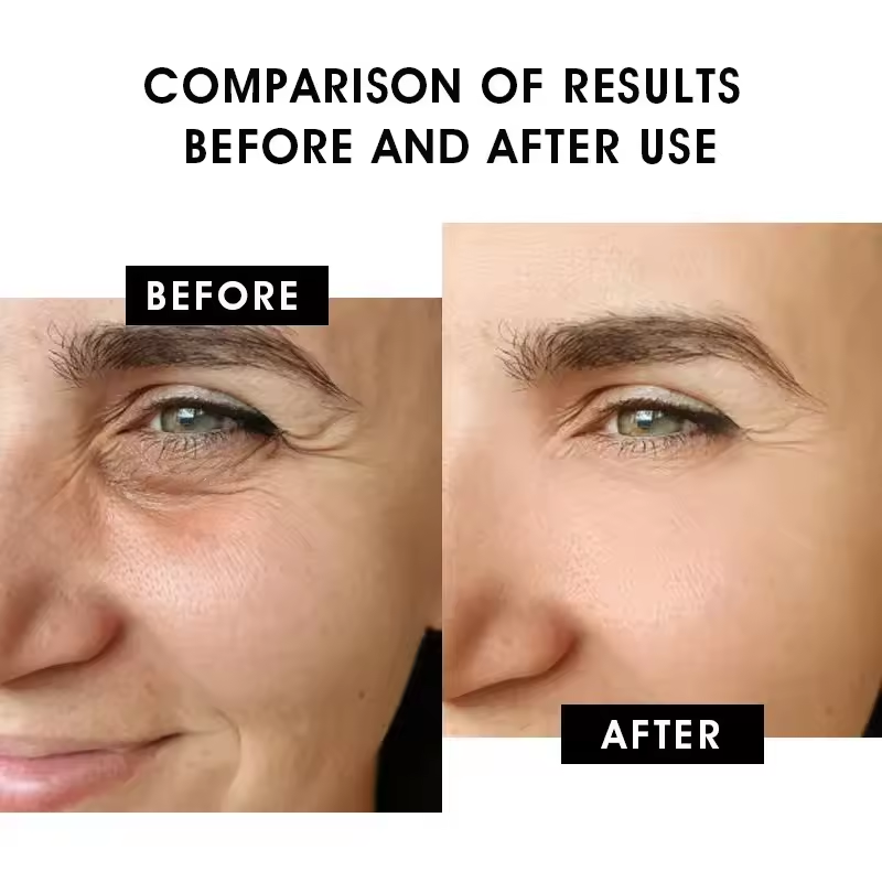Copper Peptide Serum - Anti-Aging Skin Rejuvenation, Collagen Boosting, Restores Skin Elasticity, 30ml (1.01 fl oz)