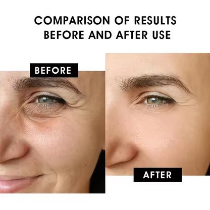 Copper Peptide Serum - Anti-Aging Skin Rejuvenation, Collagen Boosting, Restores Skin Elasticity, 30ml (1.01 fl oz)