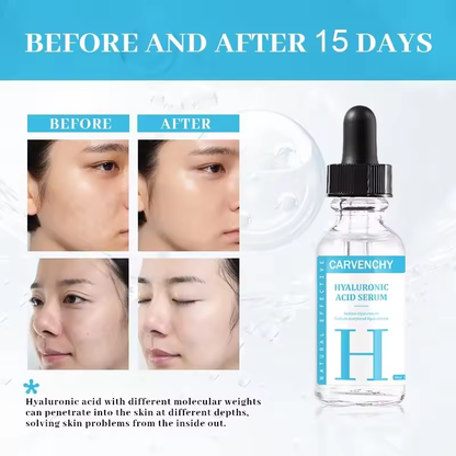 Hyaluronic Acid Serum for Deep Hydration and Anti-Aging, For All Skin Types, 30ml (1.01 fl oz)