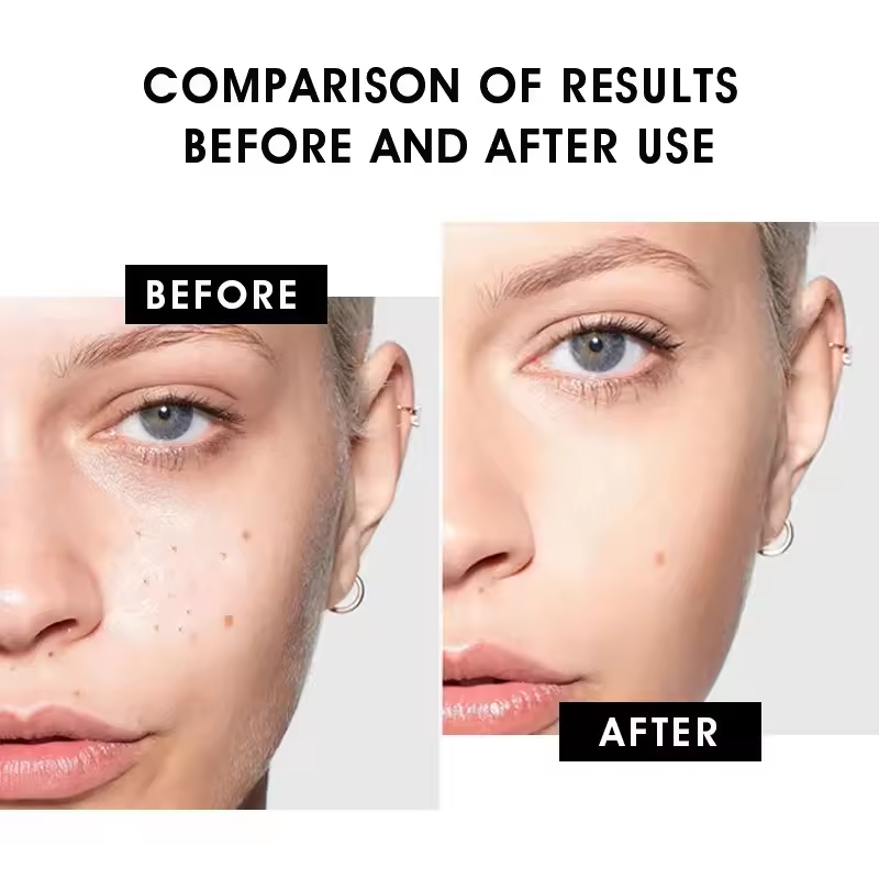 AHA+BHA Fruit Acid Serum - Natural Exfoliating and Brightening Skincare Formula, Reduces Acne and Fine Lines, Stimulates Collagen, 30ml (1.01 fl oz)
