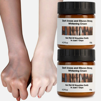 Dark Knees and Elbows Strong Whitening Cream - Powerful Skin Lightening, Moisturizing Formula for Dark Patches, Knuckles, and Elbows - Gentle, Effective Whitening Cream - 120g