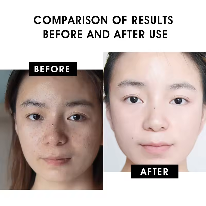 Vitamin C Serum 20% - Anti-Aging & Brightening Formula with Natural Antioxidants, Collagen & Hyaluronic Acid, Reduces Dark Spots & Wrinkles - 30ml/1.01 fl oz