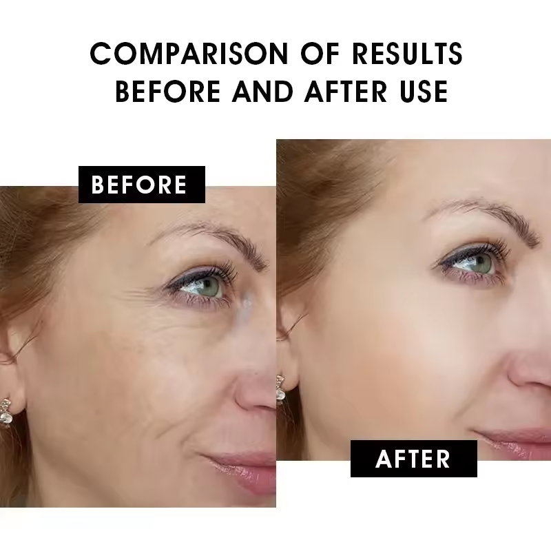Retinol Facial Serum - Anti-Aging & Collagen Boosting, 30ml (1.01 fl oz) | For All Skin Types