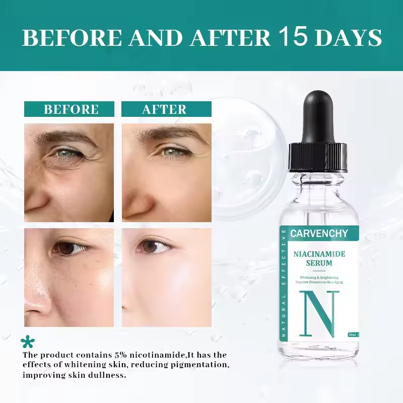 Niacinamide Serum - For Skin Brightening and Anti-Aging, 30ml