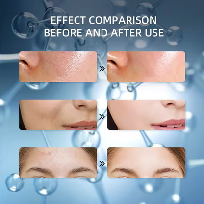 Carvenchy Bio-Collagen Real Deep Mask - Hydrating Facial Treatment for Radiant Skin, Enhanced Elasticity & Soothing Effect