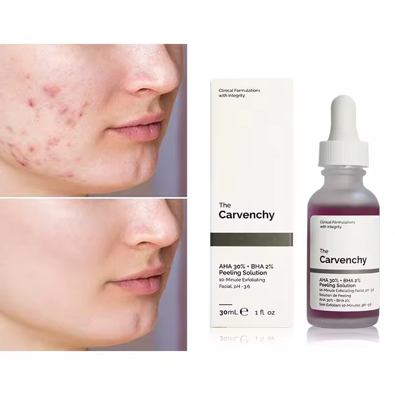 The AHA 30% + BHA 2% Peeling Solution – 10-Minute Exfoliating Facial for Radiant Skin, Clinical Formulations with Integrity, 30ml