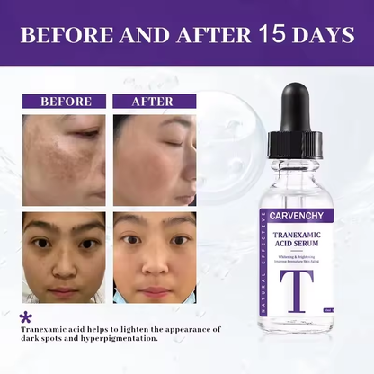 Tranexamic Acid Facial Serum - Skin Whitening and Brightening, All Skin Types, 30ml