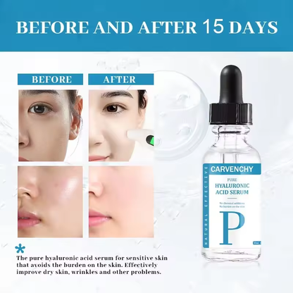 Pure Hyaluronic Acid Serum for Deep Hydration and Anti-Aging, 30ml (1.01 fl oz)