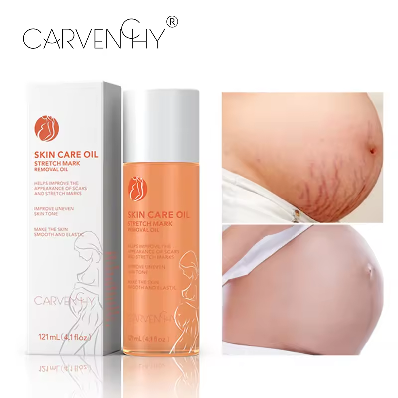 Advanced Stretch Mark Removal Oil - Skin Care Oil for Scars, Pregnancy Stretch Marks, and Uneven Skin Tone - 121mL
