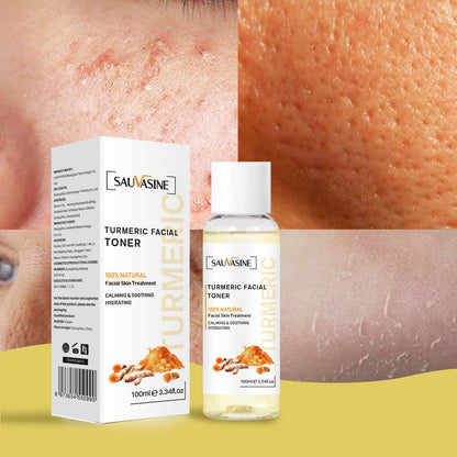 Britains Beauty Turmeric Facial Toner - 100% Natural Skin Treatment, Calming & Soothing Hydration, Reduces Acne, Pore Tightening, Dark Spot Reduction, 100ml