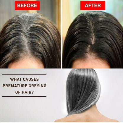 White Hair Darkening Spray with Herbal Ingredients, Restores Natural Color, Anti-Dandruff, Nourishes Hair Follicles, Reduces Itching & Flaky Scalp - 50ml