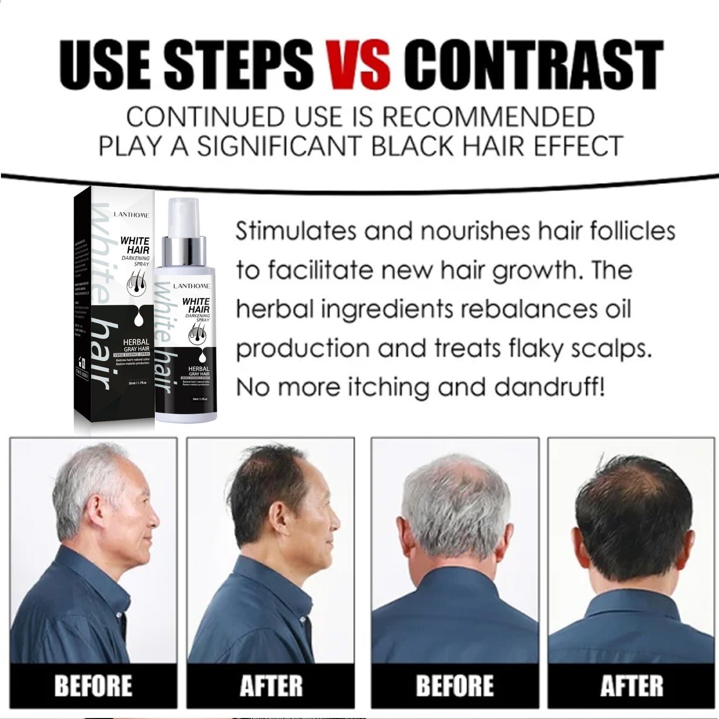 White Hair Darkening Spray with Herbal Ingredients, Restores Natural Color, Anti-Dandruff, Nourishes Hair Follicles, Reduces Itching & Flaky Scalp - 50ml