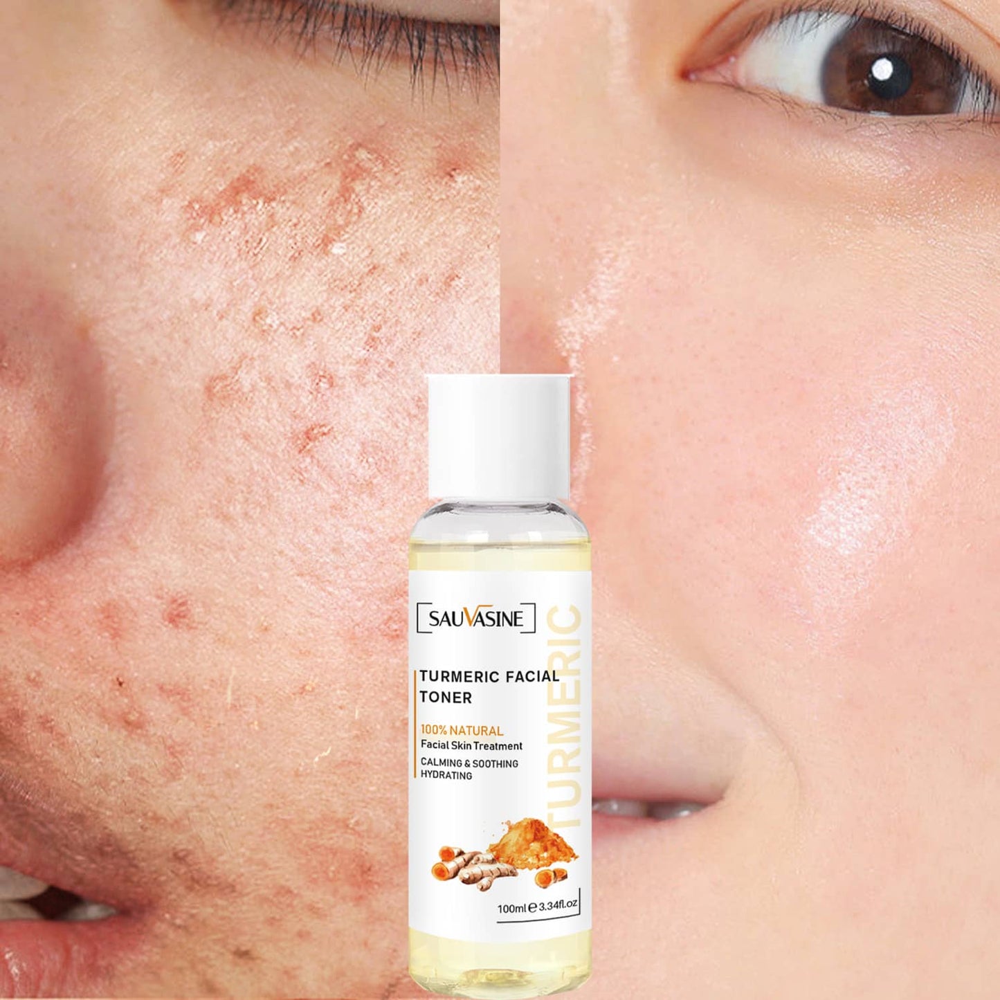 Britains Beauty Turmeric Facial Toner - 100% Natural Skin Treatment, Calming & Soothing Hydration, Reduces Acne, Pore Tightening, Dark Spot Reduction, 100ml