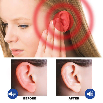 Britains Beauty Tinnidrop Tinnitus Relief Spray – Fast Acting, Natural Ingredients, Eases Ear Ringing, Reduces Ear Pain, Improves Hearing, Safe and Effective Formula