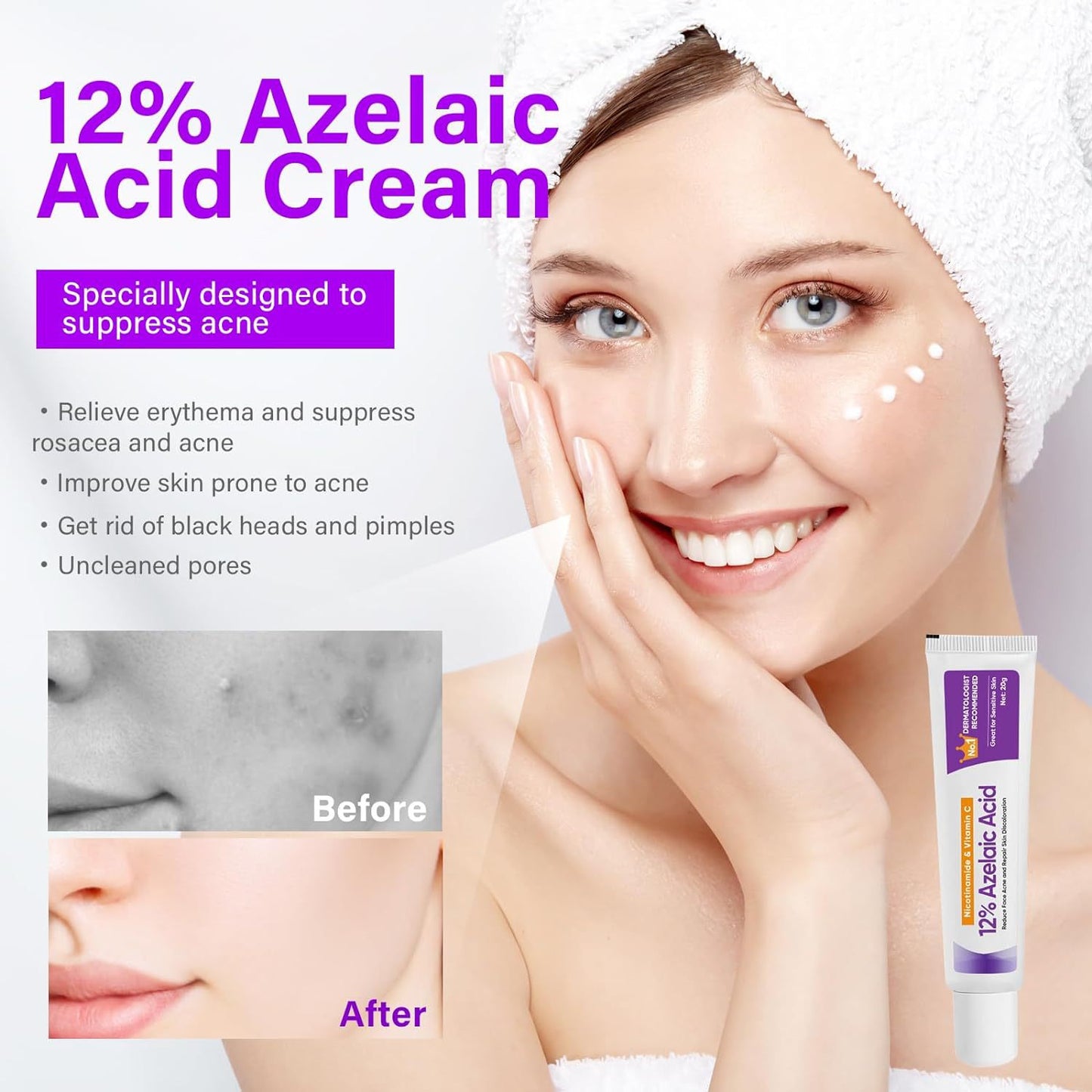 NourishMax Skin Clarifying 12% Azelaic Acid Cream - Dermatologist Recommended, Reduce Acne, Rosacea, and Discoloration, Face & Neck Brightening Formula, 20g