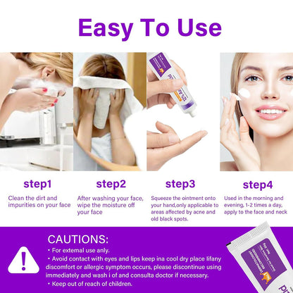 NourishMax Skin Clarifying 12% Azelaic Acid Cream - Dermatologist Recommended, Reduce Acne, Rosacea, and Discoloration, Face & Neck Brightening Formula, 20g