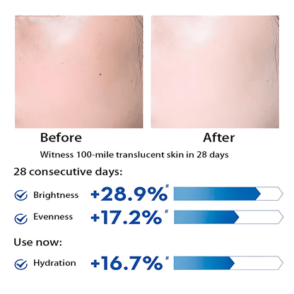 Niacinamide 10% + Zinc 1% Serum - Advanced Whitening, Oil Control, Anti-Aging, Pore Shrinking & Spot Lightening Treatment, 30ml