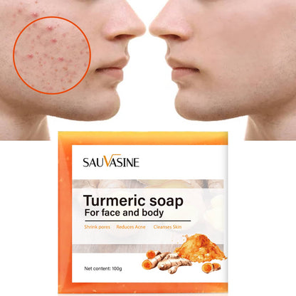 Britains Beauty Turmeric Soap for Face and Body - Natural Acne Treatment, Pore Shrinker, Anti-Inflammatory, Skin Cleanser - 100g