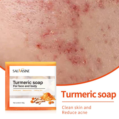 Britains Beauty Turmeric Soap for Face and Body - Natural Acne Treatment, Pore Shrinker, Anti-Inflammatory, Skin Cleanser - 100g