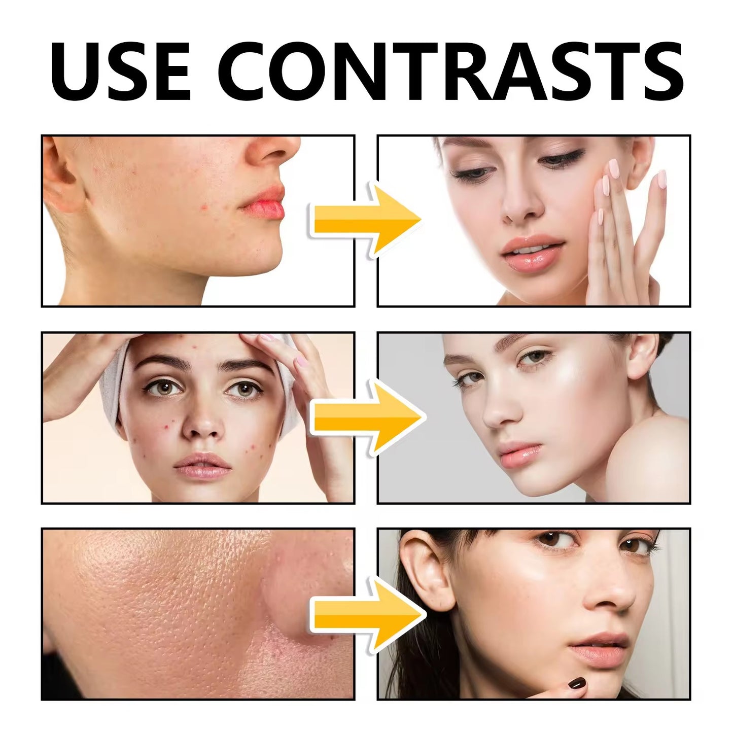 Tea Trees Cleanser with Tea Tree Oil & Centella Asiatica - Deep Pore Cleansing and Acne Treatment - 100g / 3.53 oz